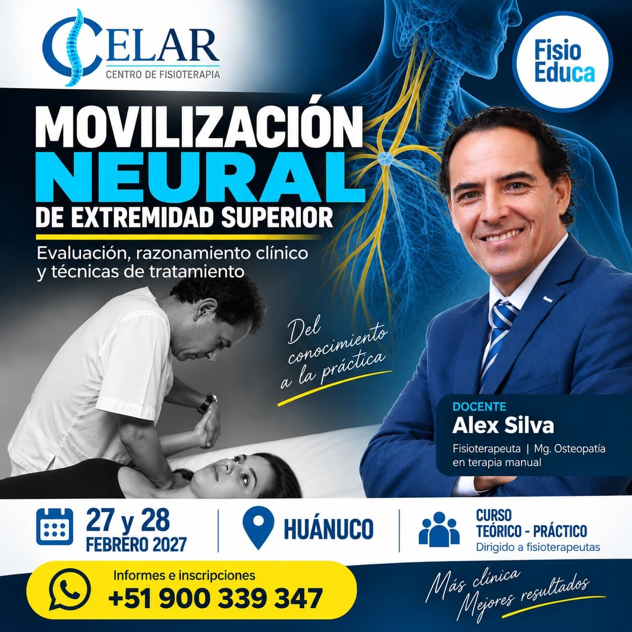 Movilizaciín Neural de Extremidad Superior